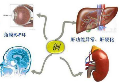 銅元素超標危害大